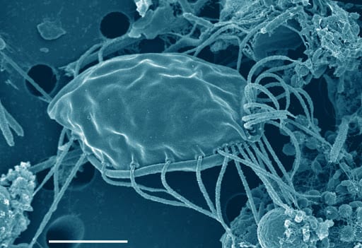 Virus eating protists