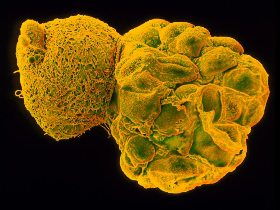 Artificial Embryo